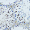 Immunohistochemistry of paraffin-embedded Mouse testis using NR1I3 Polyclonal Antibody at dilution of  1:200 (40x lens).