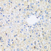 Immunohistochemistry of paraffin-embedded Rat liver using ARL4A Polyclonal Antibody at dilution of  1:100 (40x lens).