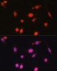 Immunofluorescence analysis of U2OS cells using DDX17 Polyclonal Antibody at dilution of  1:100. Blue: DAPI for nuclear staining.