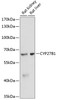 Western blot analysis of extracts of various cell lines using CYP27B1 Polyclonal Antibody at dilution of 1:3000.