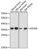 Western blot analysis of extracts of various cell lines using ATOH8 Polyclonal Antibody at dilution of 1:1000.