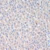 Immunohistochemistry of paraffin-embedded Rat liver using LRRK2 Polyclonal Antibody at dilution of  1:200 (40x lens).