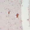 Immunohistochemistry of paraffin-embedded Rat brain using LRRK2 Polyclonal Antibody at dilution of  1:200 (40x lens).