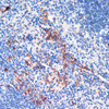 Immunohistochemistry of paraffin-embedded Mouse spleen using LRRK2 Polyclonal Antibody at dilution of  1:200 (40x lens).