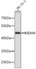 Western blot analysis of extracts of ZR-75-1 cells using MDM4 Polyclonal Antibody.