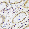 Immunohistochemistry of paraffin-embedded Human gastric using UBE3A Polyclonal Antibody at dilution of  1:200 (40x lens).