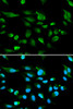 Immunofluorescence analysis of A549 cells using AIRE Polyclonal Antibody
