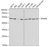 Western blot analysis of extracts of various cell lines using IFNAR2 Polyclonal Antibody at dilution of 1:1000.