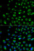 Immunofluorescence analysis of U2OS cells using IFNAR2 Polyclonal Antibody