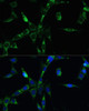 Immunofluorescence analysis of NIH-3T3 cells using BUB1B Polyclonal Antibody at dilution of  1:100. Blue: DAPI for nuclear staining.