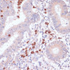 Immunohistochemistry of paraffin-embedded Human colon using CD82 Polyclonal Antibody at dilution of  1:100 (40x lens).