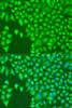 Immunofluorescence analysis of U2OS cells using KIR2DS4 Polyclonal Antibody at dilution of  1:100. Blue: DAPI for nuclear staining.