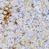 Immunohistochemistry of paraffin-embedded Rat kidney using TFF1 Polyclonal Antibody at dilution of  1:200 (40x lens).