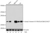 Western blot analysis of extracts of various cell lines using Acetyl-Histone H3-K9/K14/K18/K23/K27 Polyclonal Antibody at dilution of 1:1000. HeLa cells were treated by TSA (1 uM) at 37°C for 18 hours. NIH/3T3 cells were treated by TSA (1 uM) at 37°C for 18 hours. C6 cells were treated by TSA (1 uM) at 37°C for 18 hours.