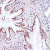 Immunohistochemistry of paraffin-embedded Rat lung using Acetyl-Histone H3-K9/K14/K18/K23/K27 Polyclonal Antibody at dilution of  1:100 (40x lens).