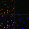 Immunofluorescence analysis of NIH/3T3 cells using Acetyl-Histone H3-K9/K14/K18/K23/K27 Polyclonal Antibody at dilution of  1:100. Blue: DAPI for nuclear staining.NIH/3T3 cells were treated by TSA (1 uM) at 37℃ for 18 hours. Blue: DAPI for nuclear staining.