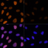 Immunofluorescence analysis of U-2 OS cells using Acetyl-Histone H3-K9/K14/K18/K23/K27 Polyclonal Antibody at dilution of  1:100. Blue: DAPI for nuclear staining.U2OS cells were treated by TSA (1 uM) at 37℃ for 18 hours. Blue: DAPI for nuclear staining.
