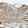 Immunohistochemistry of paraffin-embedded Mouse heart using PDE3A Polyclonal Antibody at dilution of  1:100 (40x lens).