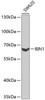 Western blot analysis of extracts of SW620 cells using BIN1 Polyclonal Antibody at dilution of 1:1000.