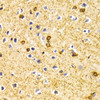 Immunohistochemistry of paraffin-embedded Rat brain using BIN1 Polyclonal Antibody at dilution of  1:100 (40x lens).