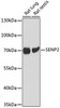 Western blot analysis of extracts of various cell line using SENP2 Polyclonal Antibody at dilution of 1:1000.