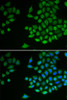 Immunofluorescence analysis of MCF-7 cells using PTPN2 Polyclonal Antibody