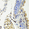 Immunohistochemistry of paraffin-embedded Mouse lung using SDC2 Polyclonal Antibody at dilution of  1:100 (40x lens).