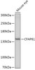 Western blot analysis of extracts of Mouse eye using CFAP61 Polyclonal Antibody at dilution of 1:1000.