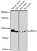Western blot analysis of extracts of various cell lines using MED15 Polyclonal Antibody at dilution of 1:1000.