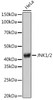 Western blot analysis of extracts of HeLa cells using JNK1/2 Polyclonal Antibody at dilution of 1:500.