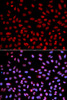 Immunofluorescence analysis of U2OS cells using DNA polymerase eta Polyclonal Antibody