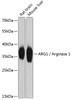 Western blot analysis of extracts of various cell lines using ARG1 / Arginase 1 Polyclonal Antibody at dilution of 1:2000.