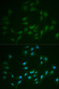 Immunofluorescence analysis of MCF-7 cells using LIG1 Polyclonal Antibody