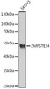 Western blot analysis of extracts of SKOV3 cells using ZMPSTE24 Polyclonal Antibody at dilution of 1:1000.
