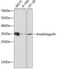 Western blot analysis of extracts of various cell lines using Amphiregulin Polyclonal Antibody at dilution of 1:1000.