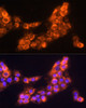 Immunofluorescence analysis of A431 cells using LAMC2 Polyclonal Antibody at dilution of  1:100 (40x lens). Blue: DAPI for nuclear staining.