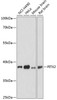 Western blot analysis of extracts of various cell lines using PITX2 Polyclonal Antibody at dilution of 1:3000.