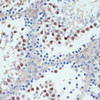 Immunohistochemistry of paraffin-embedded Mouse testis using RXRG Polyclonal Antibody at dilution of  1:100 (40x lens).