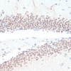 Immunohistochemistry of paraffin-embedded Mouse brain using RXRG Polyclonal Antibody at dilution of  1:100 (40x lens).