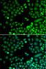 Immunofluorescence analysis of MCF-7 cells using RAD9A Polyclonal Antibody