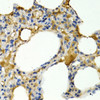 Immunohistochemistry of paraffin-embedded Rat lung using IL9 Polyclonal Antibody at dilution of  1:200 (40x lens).