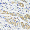 Immunohistochemistry of paraffin-embedded Human stomach using IL11 Polyclonal Antibody at dilution of  1:100 (40x lens).