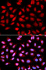 Immunofluorescence analysis of U2OS cells using PPP2R4 Polyclonal Antibody