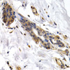 Immunohistochemistry of paraffin-embedded Human normal breast using PKLR Polyclonal Antibody at dilution of  1:200 (40x lens).