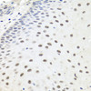 Immunohistochemistry of paraffin-embedded Human esophagus using EXO1 Polyclonal Antibody at dilution of  1:100 (40x lens).