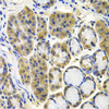 Immunohistochemistry of paraffin-embedded Human colon carcinoma using APBB1 Polyclonal Antibody at dilution of  1:100 (40x lens).