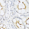 Immunohistochemistry of paraffin-embedded Human colon using CCL22 Polyclonal Antibody at dilution of  1:100 (40x lens).