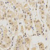 Immunohistochemistry of paraffin-embedded Human stomach using PSMB5 Polyclonal Antibody at dilution of  1:200 (40x lens).