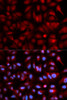 Immunofluorescence analysis of U2OS cells using PSMB5 Polyclonal Antibody