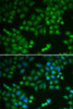 Immunofluorescence analysis of MCF-7 cells using RPL5 Polyclonal Antibody